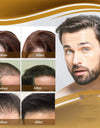 Anti Hair Loss Hair Nourishing Liquid Hair Firming And Hair Increasing