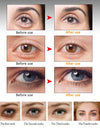 ARTISCARE Anti Eye cream