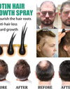 Anti Hair Loss Hair Nourishing Liquid Hair Firming And Hair Increasing