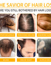 Hair Growth Repair Care Essential Oil